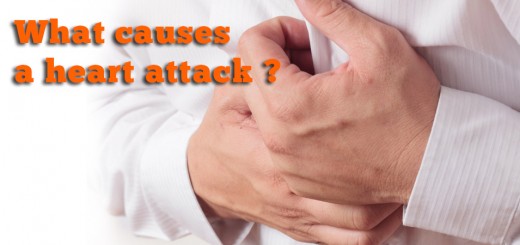 What causes a heart attack