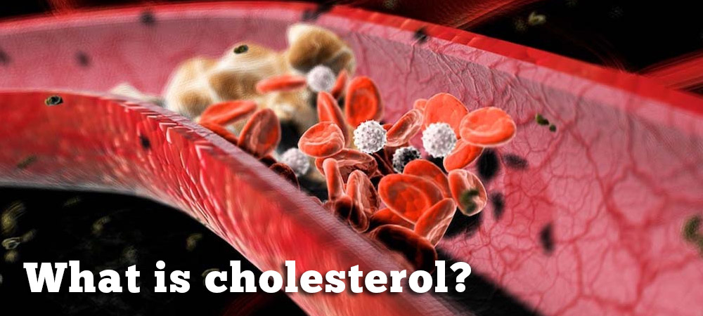 What is cholesterol?