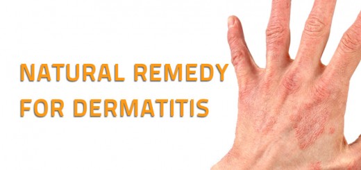 Natural Remedy for Dermatitis
