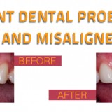 Frequent dental problems yellow and misaligned teeth 2