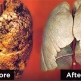 How To Clean Your Lungs Easily In Just 3 Days