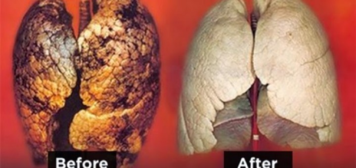 How To Clean Your Lungs Easily In Just 3 Days