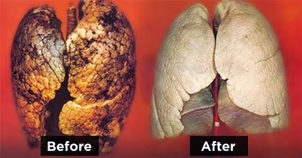 How To Clean Your Lungs Easily In Just 3 Days